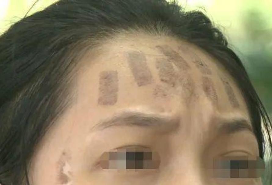 成都光子嫩膚價格，科技重塑肌膚之美